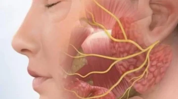 نقص التغذية يظهر بوضوح في الوجه شحوب، تشققات وهالات داكنة تحذر من مخاطر صحية تستدعي استشارة طبية عاجلة 1